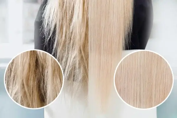 What's the Future of Nanoplastia Treatment?