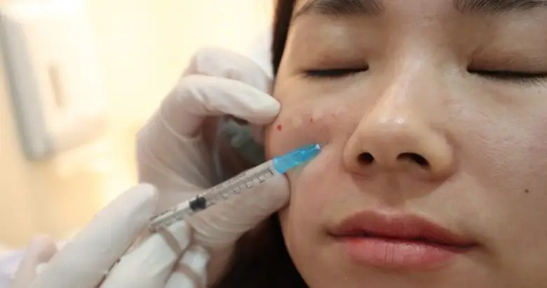 What is Rejuran treatment?